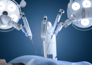 DaVinci, chirurgia robotowa - błąd lekarski